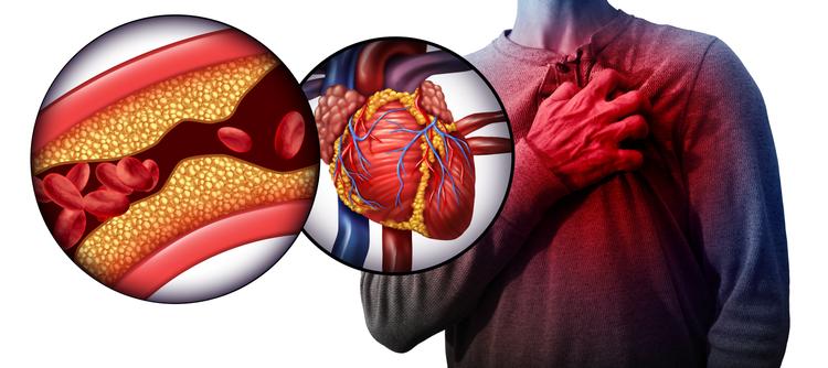 Aumenta o número de mortes por doenças cardiovasculares no primeiro semestre de 2021