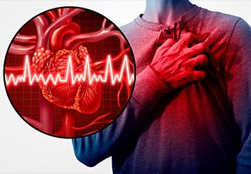 Sessão de exercício não promove lesão miocárdica em pacientes com angina refratária, aponta estudo