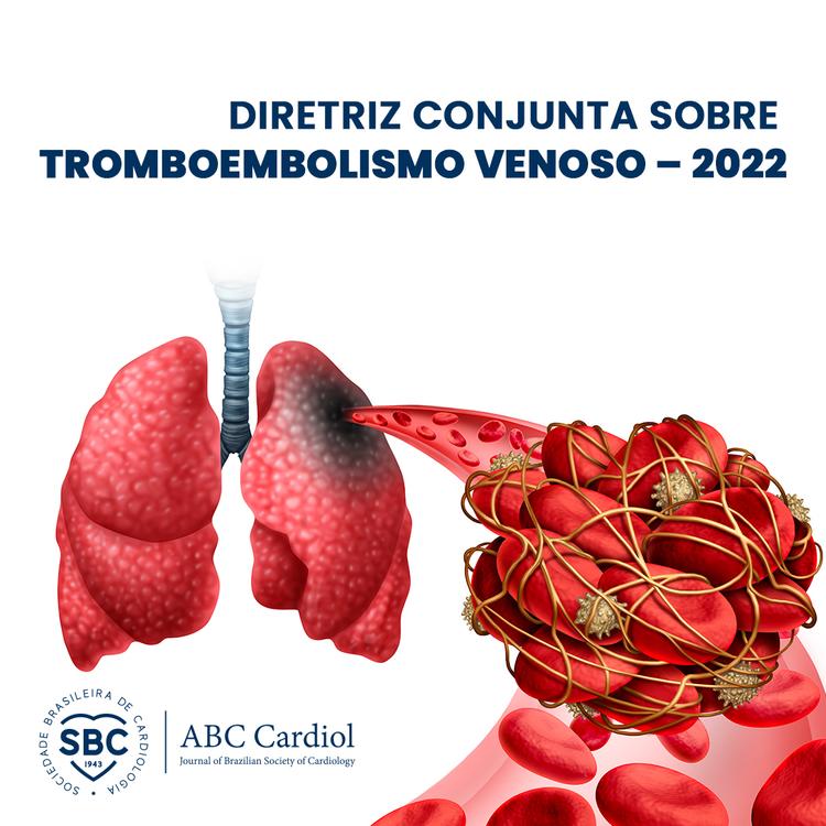 ABC Cardiol de abril publica Diretriz Conjunta sobre Tromboembolismo Venoso (TEV)