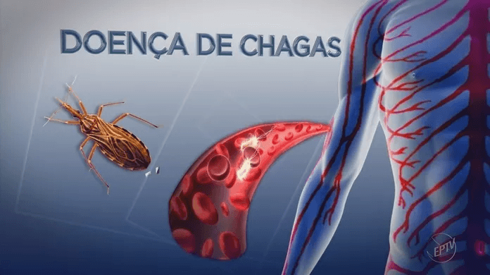 SBC lançará nova diretriz sobre a cardiomiopatia da doença de Chagas durante 77º CBC
